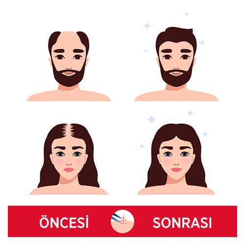 sac-ekimi-oncesi-sonrasi
